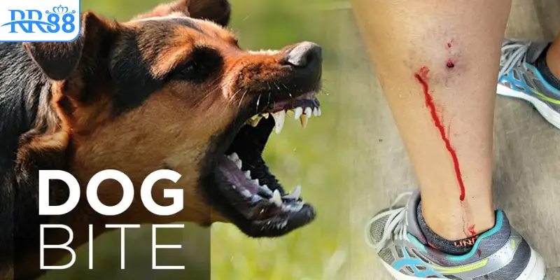 Mơ chó lạ cắn vào chân chảy máu 